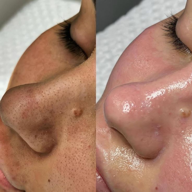 الحالة الأولى